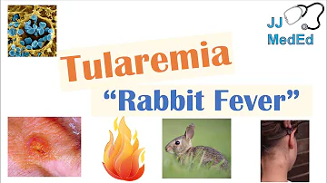 Che cos'è la tularemia?