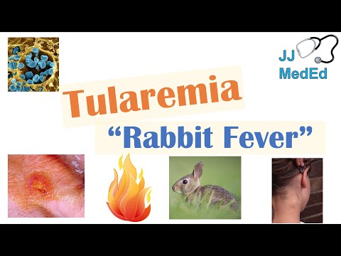 Videó: Tularemia Emberben - A Tularemia Kórokozója, Tünetei, Kezelése és Megelőzése