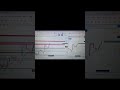 #daytrade #stock #nifty #scalpingtradingstrategy# #shortvideo