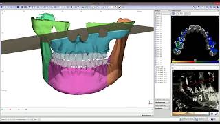 OnyxCeph³™ - All-In-One Orthodontic Imaging Software OnyxCeph³™ - All-In-One Orthodontic Imaging Software