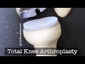 Playdough surgery  total knee arthroplasty replacement