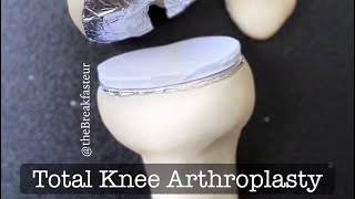 Playdough Surgery 🔪🦵🏼- Total Knee Arthroplasty (Replacement)