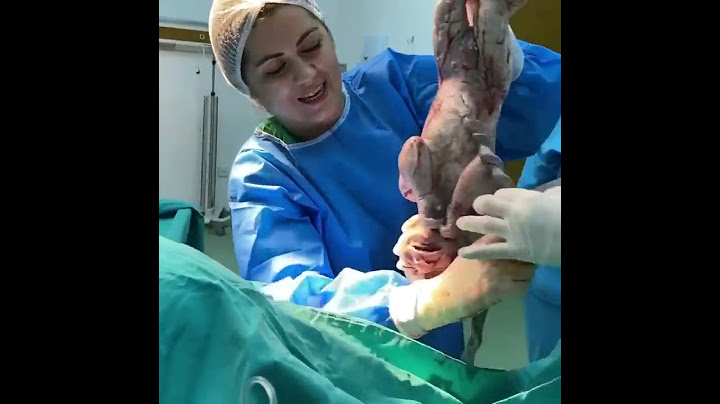 Normal Doğum(təbii doğuş)