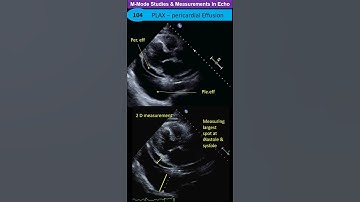 M-Mode Studies & Measurements: LV & per. eff