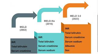 12. Indicazione a trapianto di fegato per cirrosi scompensata (eccezioni al MELD)