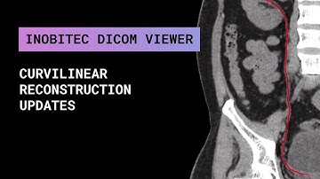 Curvilinear reconstruction updates in Inobitec DICOM Viewer Pro