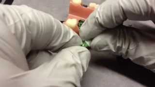 Celebrity Aeton Medical Dental Implant Burn-out Coping for the Straumann type Solid Abutment Net Worth