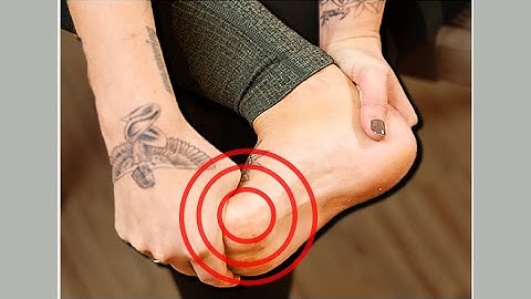 𝟮 𝗘𝘅𝗲𝗿𝗰𝗶𝘀𝗲𝘀: Hallux Rigidus Self Treatment // Big Toe Arthritis Exercises