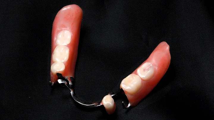 Cleaning Partial Dentures