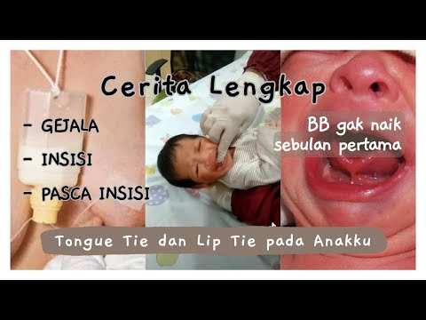 Bawah Lidah Bayi Normal