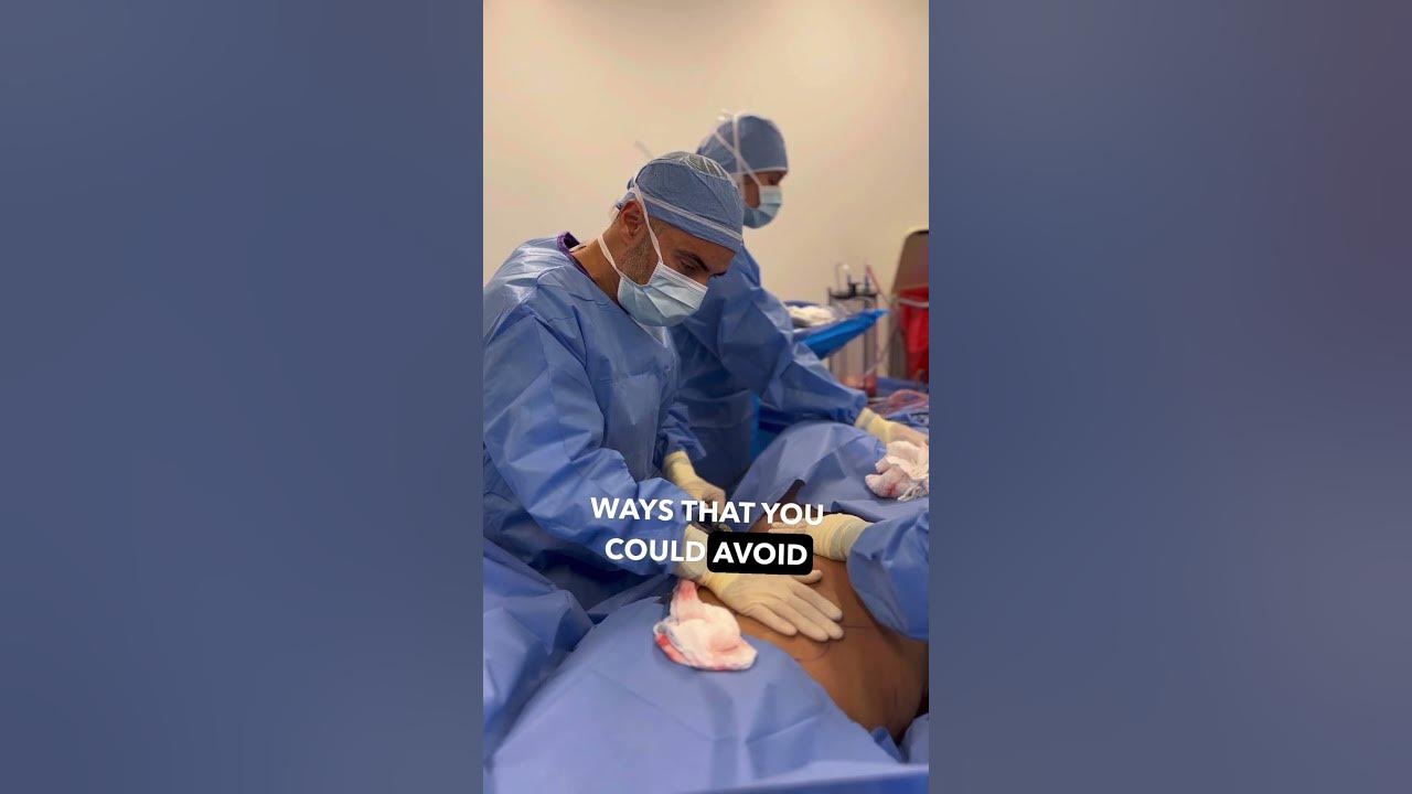 Can you get Plastic Surgery Awake!? YouTube