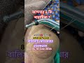 🙏আপনার ও কি সায়াটিকা?🧿🏋️‍♂️🧿🏥বালিসাই মেডিকেয়ার হাসপাতাল            🏥 এগরা মেডিল‍্যাব হাসপাতাল