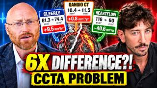 Simon Hill Just EXPOSED the CCTA Scan Problem (1,015% Difference!)