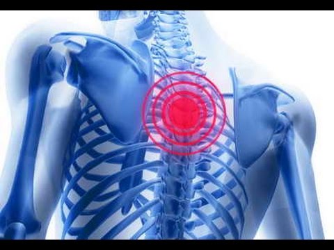 Упражнения при остеохондрозе грудного отдела позвоночника видео