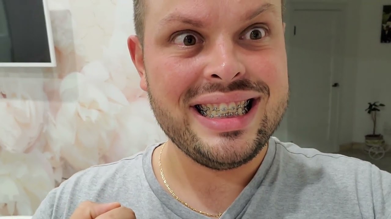 Приехал к маме ! Опухла нога ! Вкусная жарена картошка