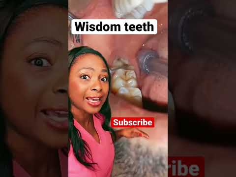Video: Prešli všetky zuby múdrosti?