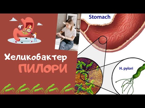 Хеликобактер Пилори 🦠 Как избавиться без антибиотиков?