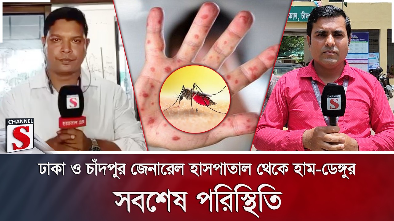 ঢাকা ও চাঁদপুর জেনারেল হাসপাতাল থেকে হাম-ডেঙ্গুর সবশেষ পরিস্থিতি | Channel S News