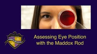 CITV 4 - Maddox Rod & Eye Position Testing