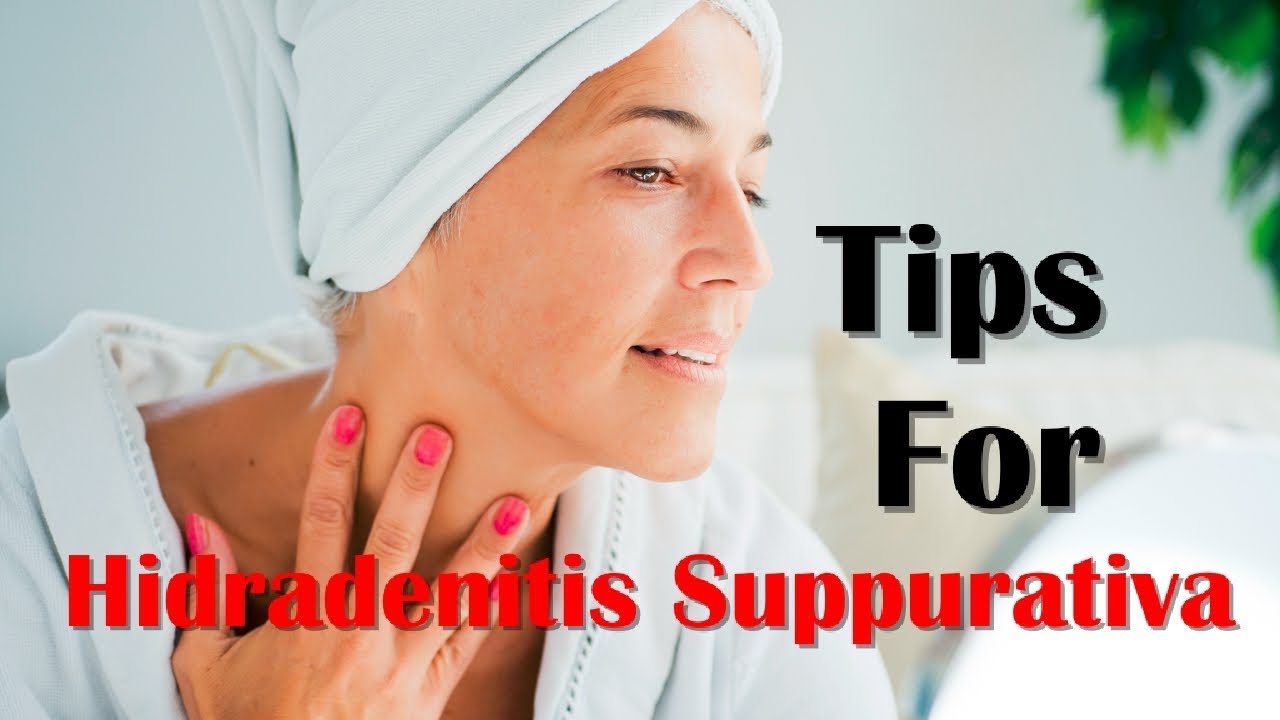 How To Cure Hidradenitis Suppurativa And Remedies For