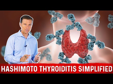 Hashimoto Thyroiditis Simplified (Autoimmune Hypothyroid)