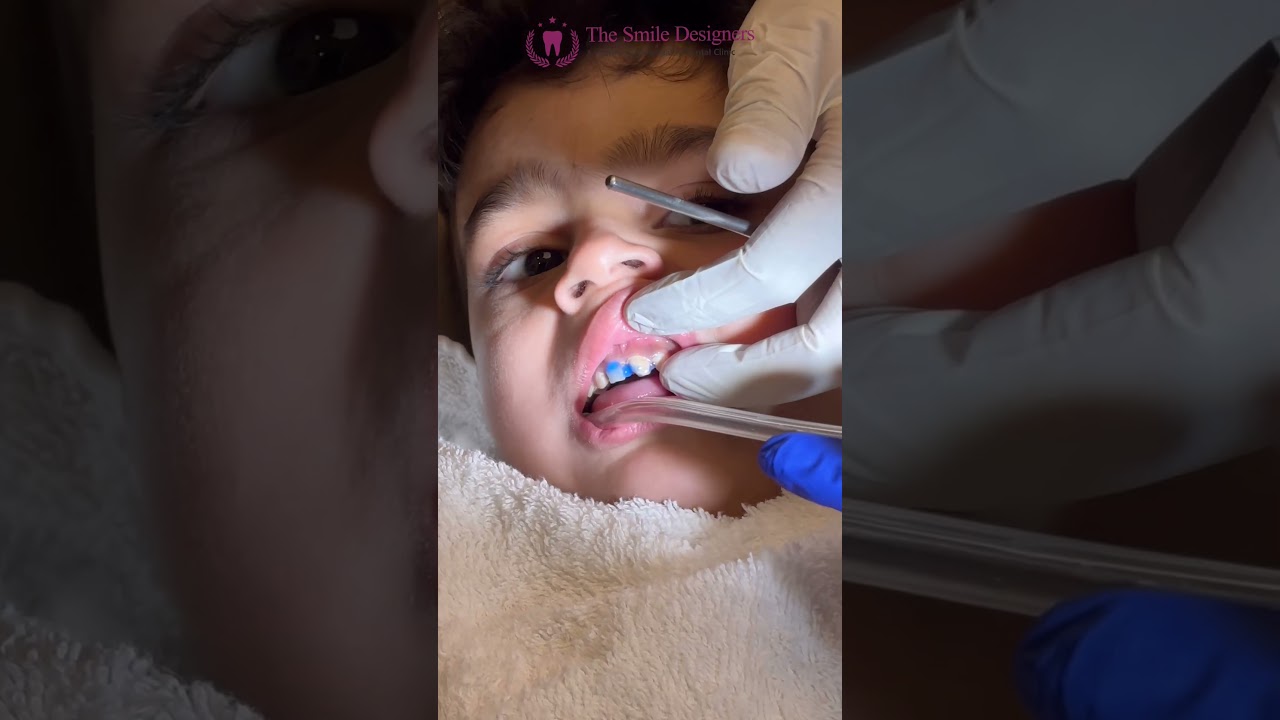 Best dentist in Chandigarh | best dentist in Mohali | 