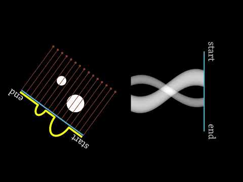 How X-ray sinogram
