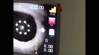 FA 6000A Auto Refractometer for Eye test Autorefractometer Autorefractor Autorefractometer#optical