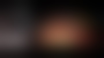 One Hundred And Five Cases Of Robotic Pancreaticoduodenectomy: Feasibility And Learning Curve Study