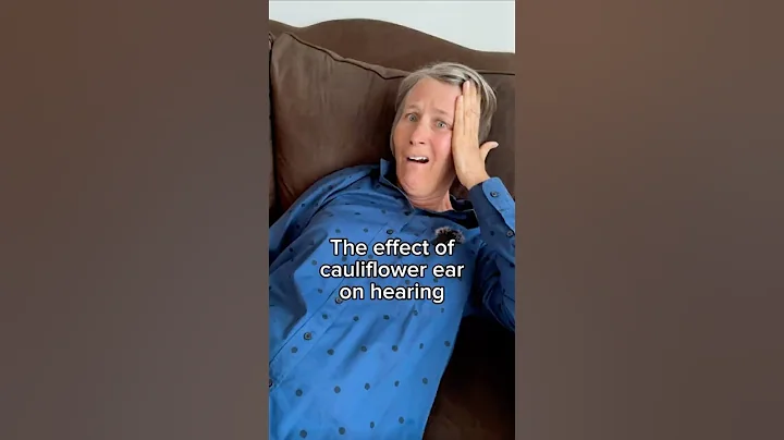 The effect of cauliflower ear on hearing