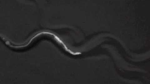 C. elegans nematode aBoc and pBoc contractions (defecation)
