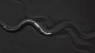 C. elegans nematode aBoc and pBoc contractions (defecation)