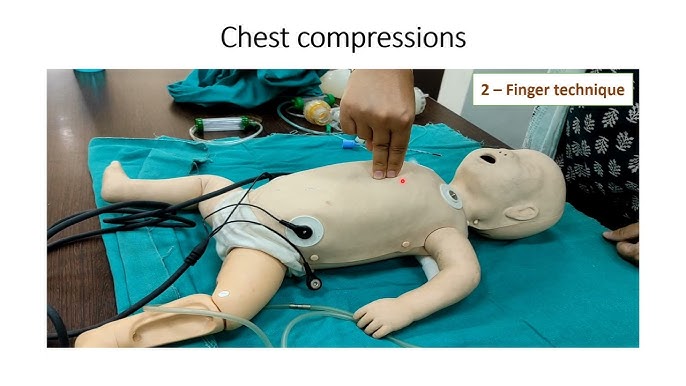 Chest Compression, Thumb Technique