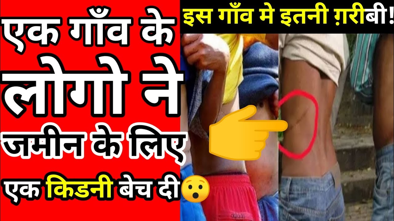 🇳🇵 Nepal की kidney velly || 