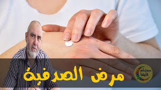 داء الصدفية أسبابها و الوصفات الطبيعية لعلاجها   - الدكتور كريم العابد العلوي -