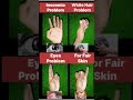 Neet UG Students MCQ Questions And Answers Bsc Nursing #youtubeshorts #ytshorts #shortvideo #shorts