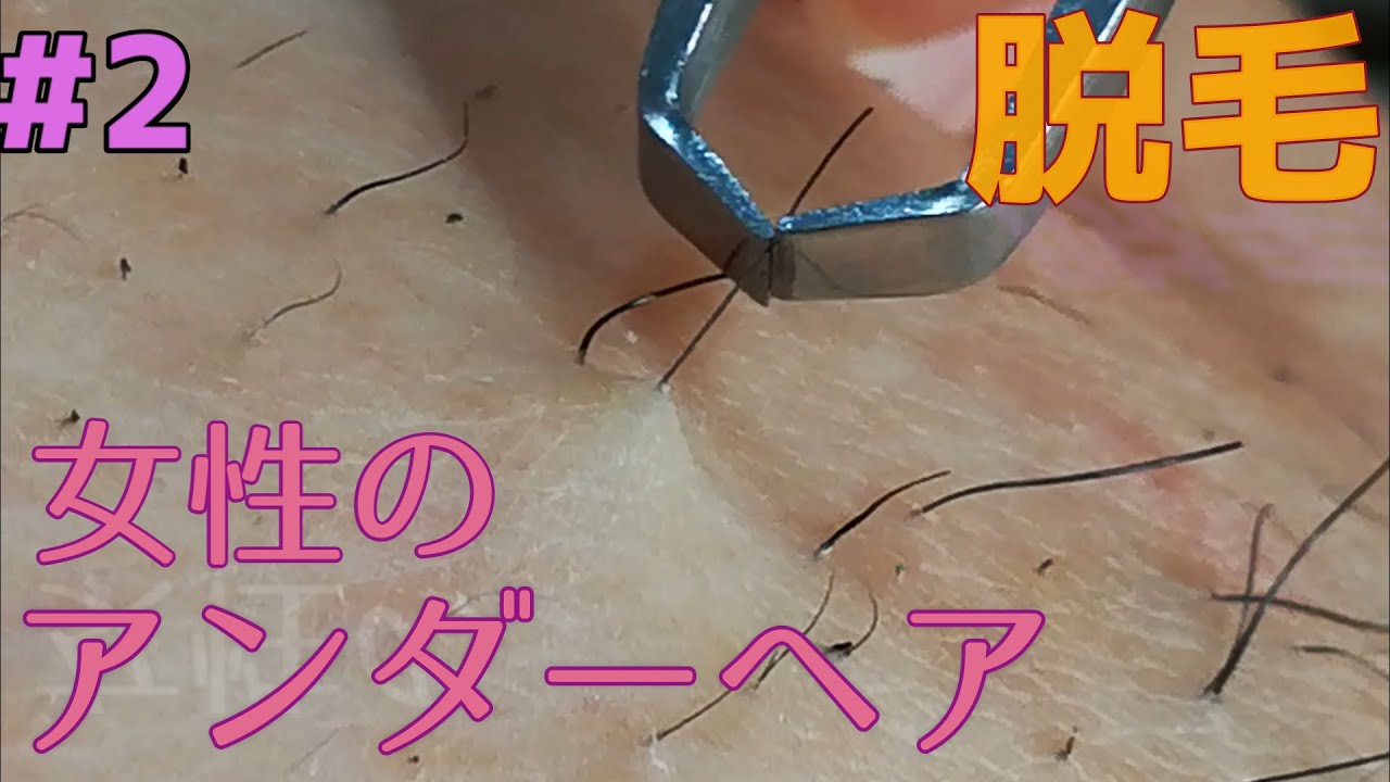 毛抜き 女性のアンダーヘアをひらすた抜きまくる 2 Youtube