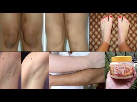 How To Lighten Your Dark Body Parts - Lighten Dark Knees, Elbows & Underarms