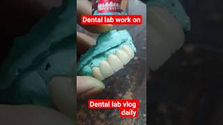 5 unit teeth dental lab work #shortsfeed #dentist