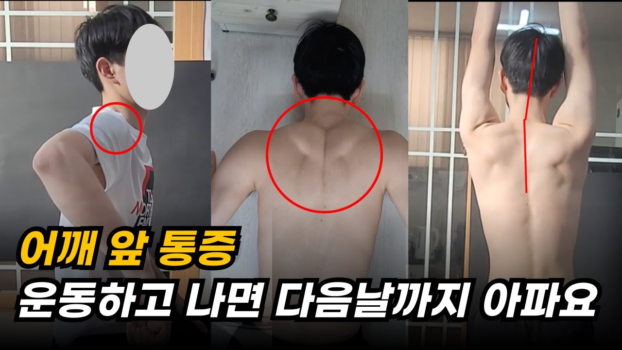 [구독자 어깨 컨설팅] 운동을 하고 나면 어깨를 쓰면 안될 것 같은 느낌이 듭니다