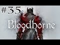 Bloodborne Millbee Plays Part {Distant