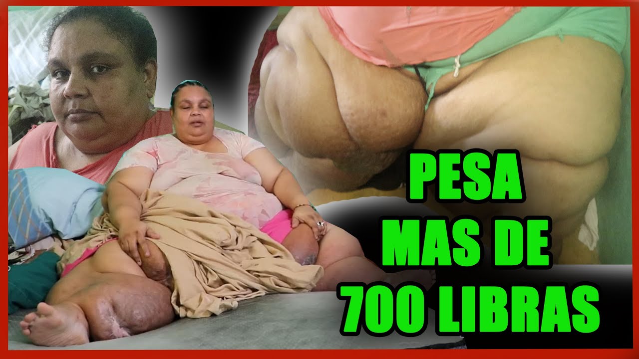 Luchando con su propio cuerpo con más de 700 libras,  su cama es su refugio!