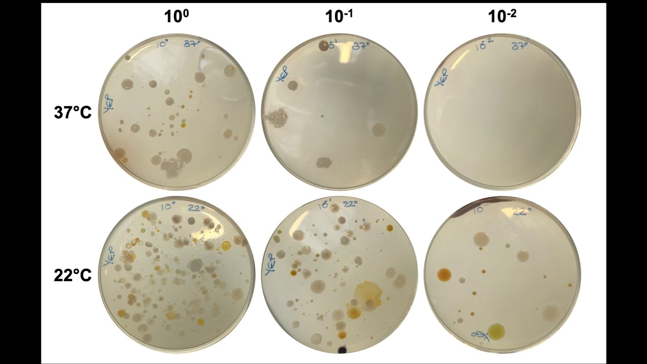 Level 2 Microbiology & Immunology | Microbiological Examination of River Water (Counting Colonies)