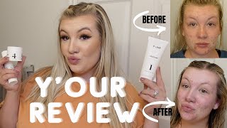 Y&#39;OUR SKINCARE REVIEW WITH BEFORE AND AFTERS! I&#39;M SHOOK!!