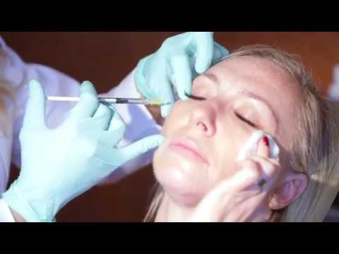 Video: Miti E Verità Di Botox