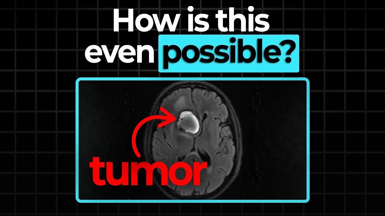 The NHS Galleri Trial: What you need to know about early cancer detection