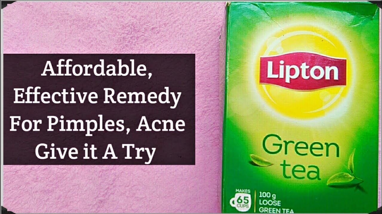 Affordable & Effective Remedy For Pimples, Acne YouTube