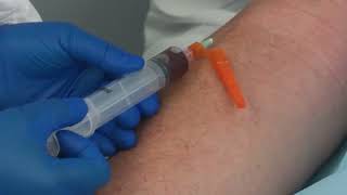 BACT/ALERT Blood Culture Collection: Needle and Syringe draw method