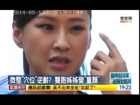 穴位逆齡 壹新聞