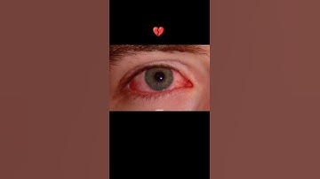 CONFIGURATION PERFECTA_para_ SAMSUNG A3,A5,A6,A7,J2, J5,J7,S5,S6,S7,S9,A10,A20,A30,A50,A70 #shorts